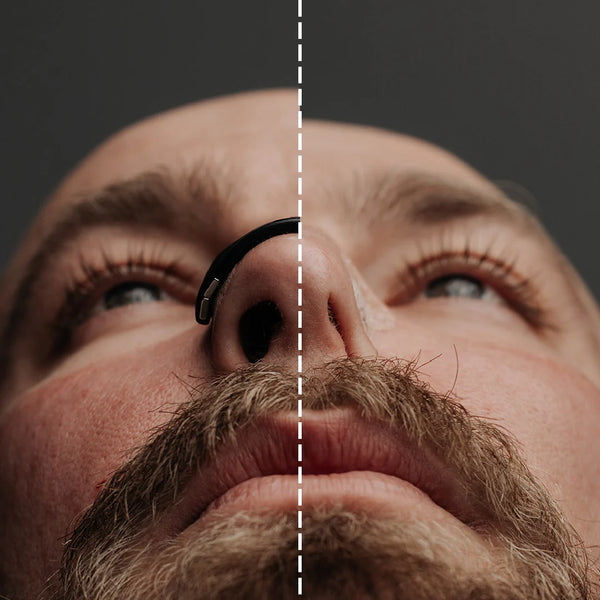 Breathing Magnetic Nasal Dilator Kit